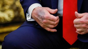 Trump, Elindeki Morlukların Sebebini Açıkladı