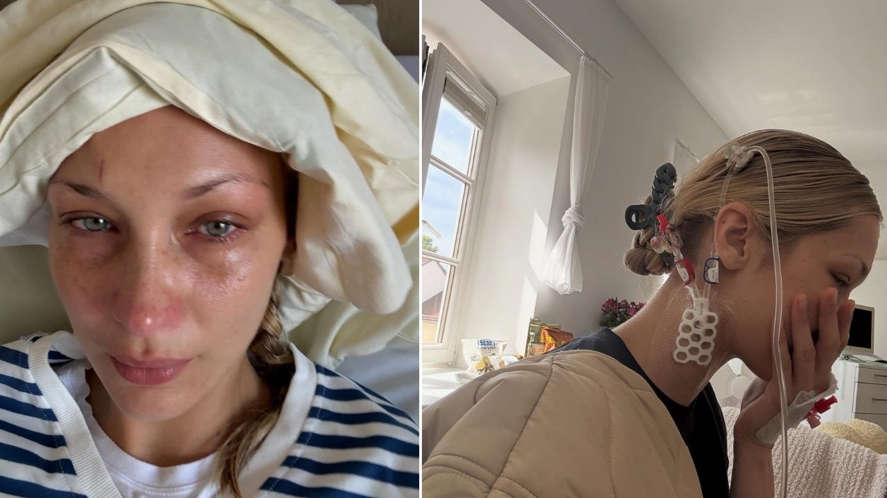 bella hadid lyme