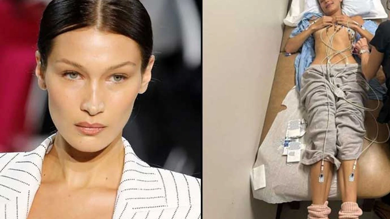 bella hadid ne hastası