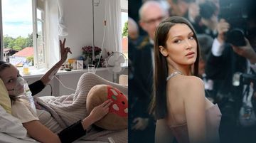 Bella Hadid’in Hastalığı Lyme Nedir? Lyme Hastalığı Belirtileri, Nedenleri ve Tedavi Yöntemleri